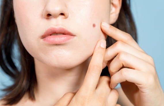 姿勢からくるお肌のトラブルにも対応| 大垣市の美容カイロプラクティックなら　Beauty Balanc CACHETTE